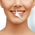 who is the best cosmetic dentist in tampa fl for teeth whitening?